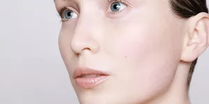 Read more about the article Zalety laserów kosmetycznych