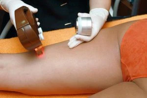 Korzystamy z wypożyczalni laserów diodowych